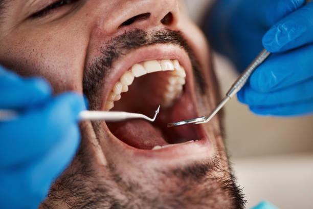 Best Emergency Gum Treatment in Nolanville, TX