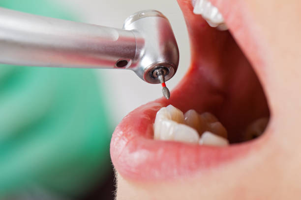 Best Same-Day Emergency Dental Services in Nolanville, TX